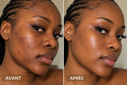 Sérum Visage Booster d'éclat - Anti-Taches